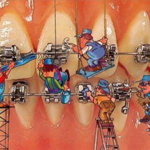 tratamiento ortodoncia madrid centro