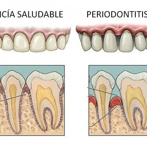 periodoncia madrid centro